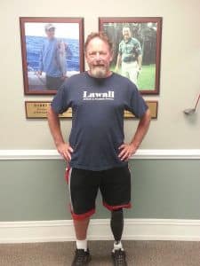 man with prosthetic leg