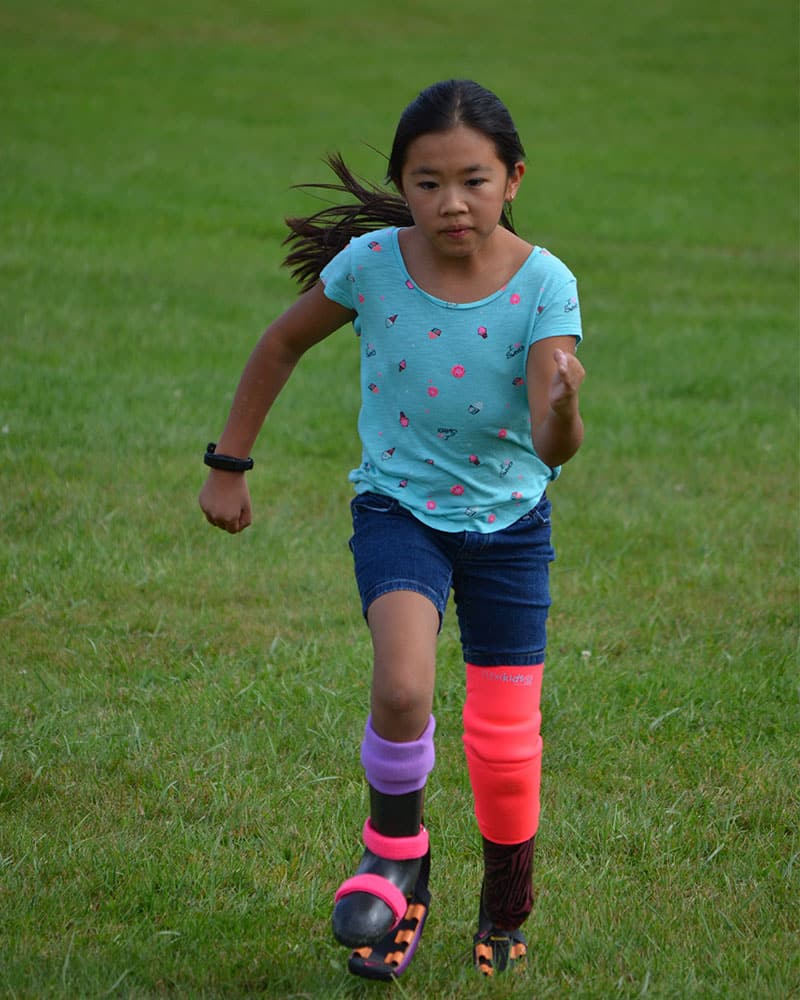 Picture of a girl running | Lawall Prosthetic & Orthotic Services