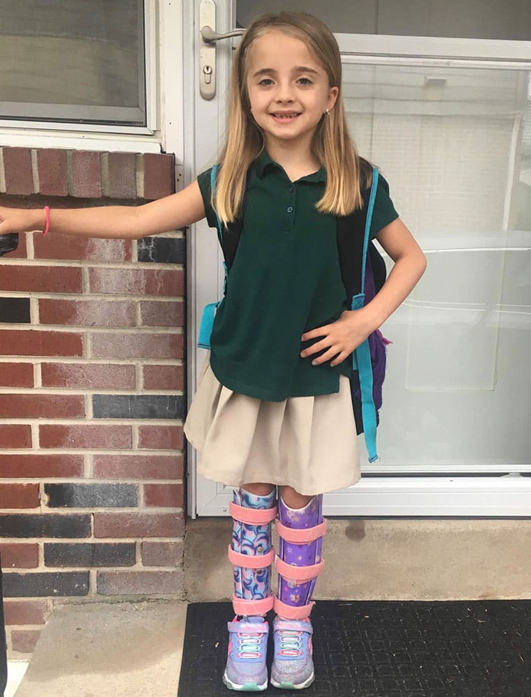 Girl with orthotics on leg | Lawall Prosthetic & Orthotic Services