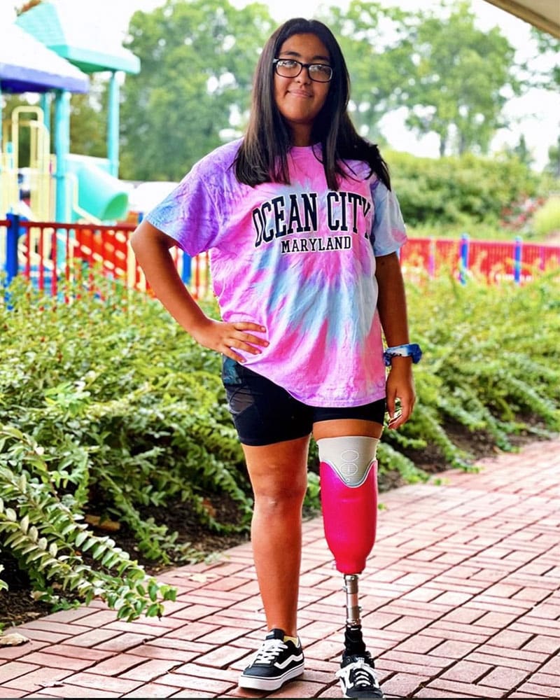 Girl with prosthetic leg | Lawall Prosthetic & Orthotic Services