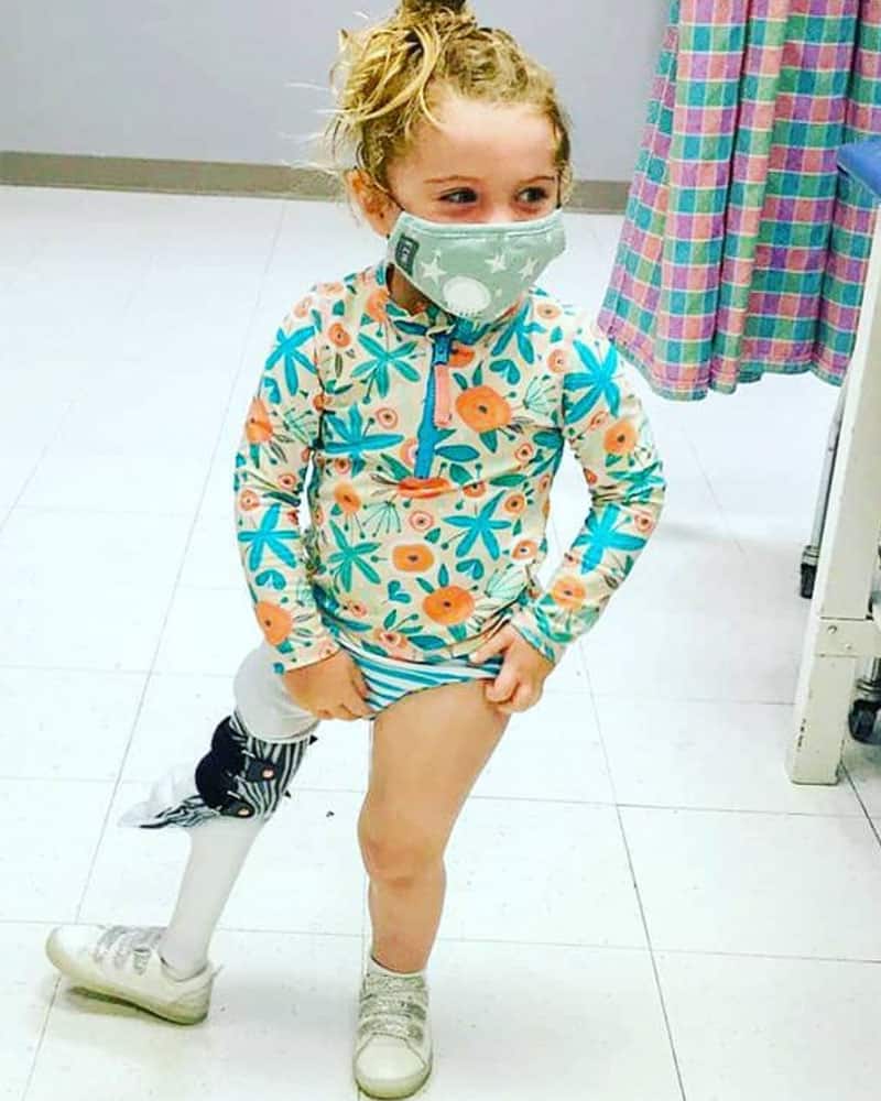 Girl with prosthetic leg | Lawall Prosthetic & Orthotic Services
